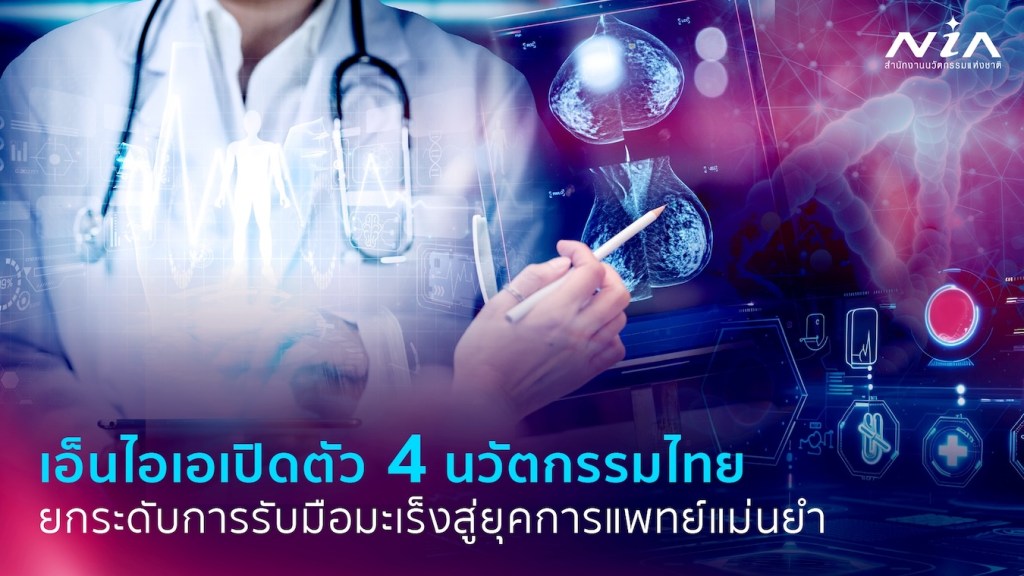 “เอ็นไอเอ”